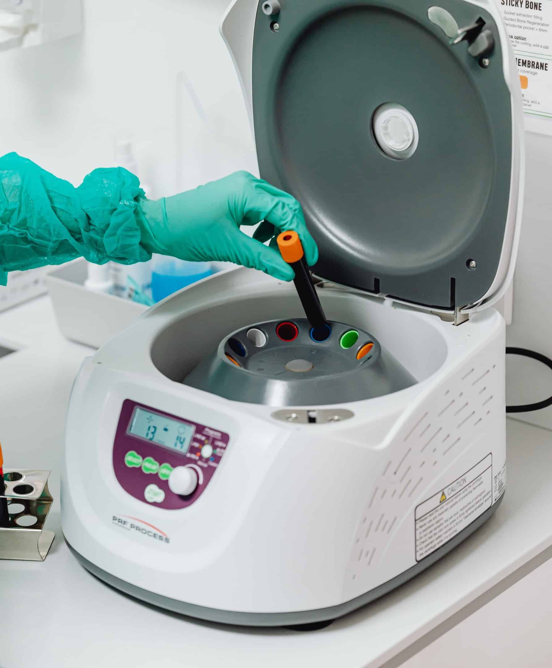 Een laboratoriummedewerker met handschoenen plaatst een bloedafnamebuisje in een centrifuge in een klinisch diagnostisch laboratorium.