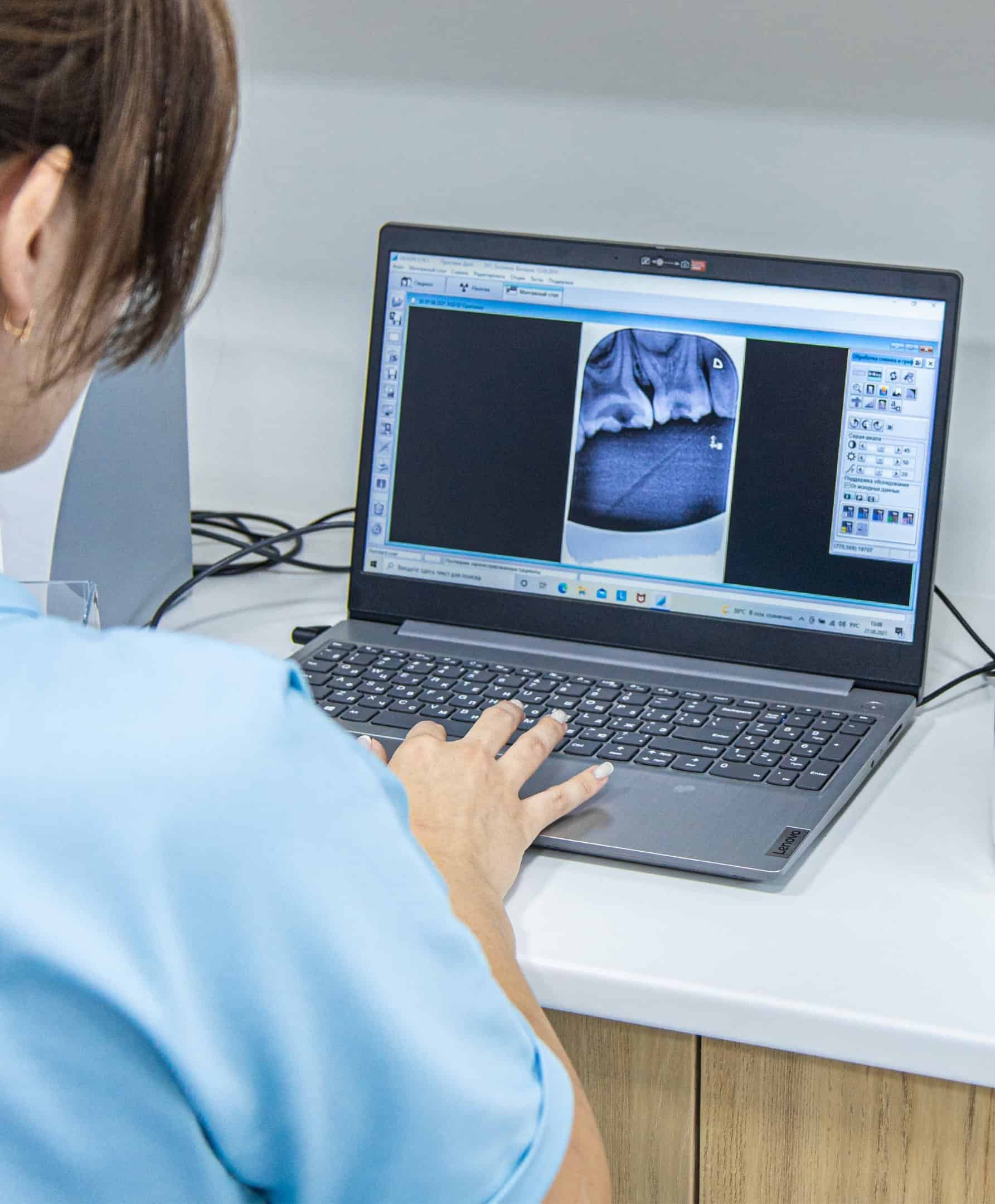 Een behandelaar bekijkt röntgenfoto's van het gebit op een laptop met behulp van medische technologie en IT-software voor de gezondheidszorg.